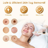 Skin Tag & Wart Removal Pen 9-Level Electric Remover Tool Kit w/ 5 Disposable Needles Reusable 39936682
